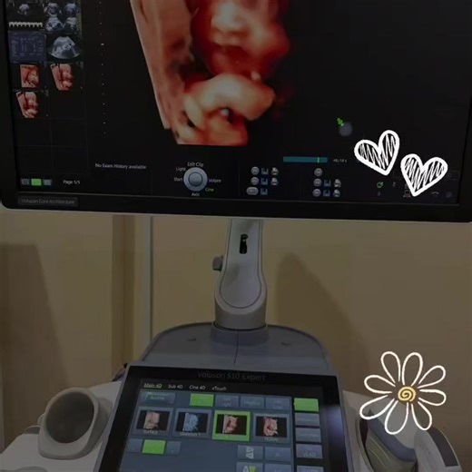 Terus-Menerus Perut kencang sesekali bisa normal. Tetapi harus diperiksa jika: • terlalu sering • terasa nyeri • terjadi sebelum usia kehamilan cukup bulan • semakin lama semakin sering Bisa menjadi tanda kontraksi prematur. Konsultasi kehamilan & kesehatan wanita ✨ bersama 👨‍⚕️ dr. H. Abdul Bari, Sp.OG 📍 Jl. Siswa, Kuala Tungkal 📲 Admin (WA): 0822-5555-66