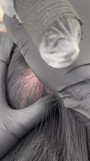 2.5K views | Don't let hair loss and thinning bring you down. With @procelltherapies hair rejuvenation treatment, you can say goodbye to those worries and book a microchanneling treatment now! ‍♀️‍♀️✨ Lets unlock the confidence and beauty within you, one follicle at a time! | Procell Therapies | Facebook