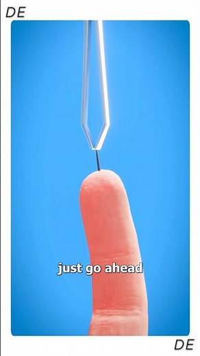 How Splinters Get Unstuck 😲 | Body Healing Process #shorts #science #medical