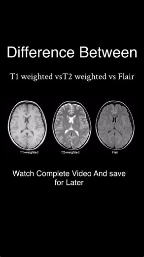 Shubham Deoli | T1 vs T2 vs Flair Image credit-oncologymedicalphysics.com #mri #radiographer #hospital #radiology #technologist #mritechnologist... | Instagram