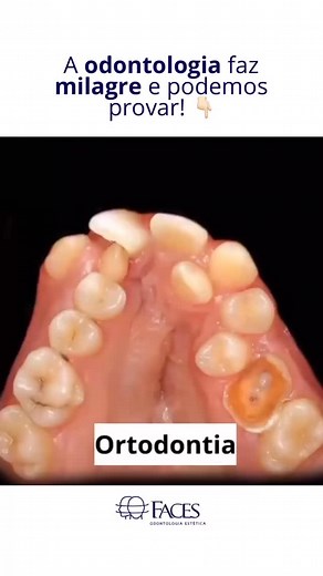 832 reactions · 11 shares | Aparelho ortodôntico não é só sobre...