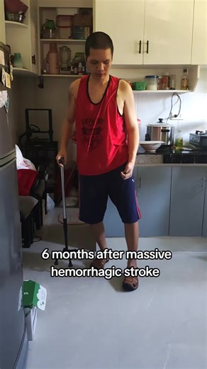 #strokesurvivor #hemorraghicstroke #craniectomy #cranioplasty #strokeawareness #fyp #stroke