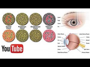 Causes Colour blindness / Types of colour blindness / Monochromacy / Dichromacy / Colour blindness