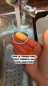 The human body can be really terrifying 😱 | The Enigma