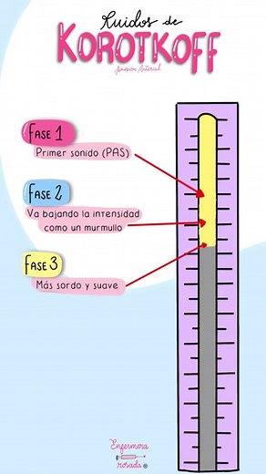14K views · 371 reactions | Los sonidos (o ruidos) de Korotkoff son...