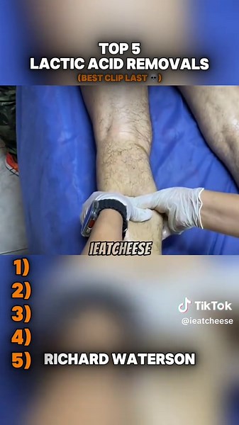 Top 5 Effective Lactic Acid Remover Techniques