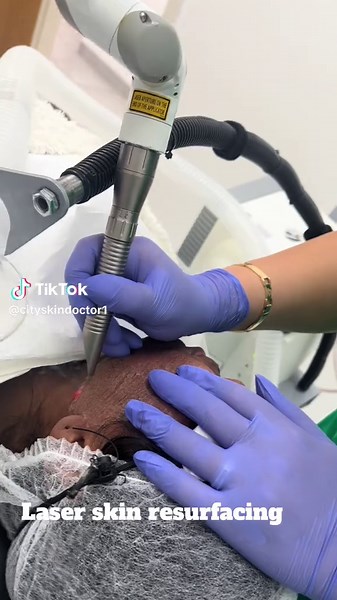 Laser Skin Resurfacing for Youthful, Smooth Skin