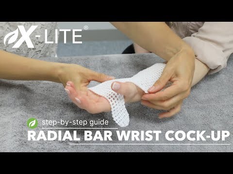 X-Lite® Radial Bar Wrist Cock-Up Guide #handtherapy
