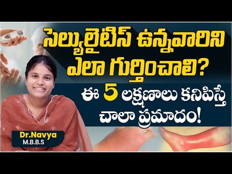 Cellulitis Major Symptoms And Treatment | Chronic Diabetes | Viral Infections | Ashwini Hospital