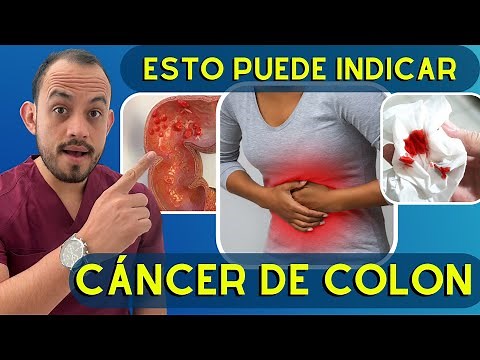 ⚠️ 6 𝗦𝗜𝗡𝗧𝗢𝗠𝗔𝗦 SILENCIOSOS del Cáncer de Colon y Recto. Detéctalo a Tiempo!