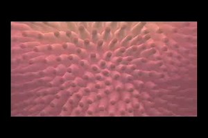 1.7K views | Get ready for Medscape Live Mixed Reality! We're streaming LIVE, "Targeting The Microbiome in GI Conditions" from ACG 2018 in Philly. To join, just come to THIS PAGE at 6PM, ET and wait for the video to begin. You don't want to miss it. | Medscape | Facebook