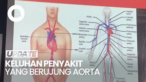 Beragam Keluhan Penyakit yang Berujung Mengidap Aorta