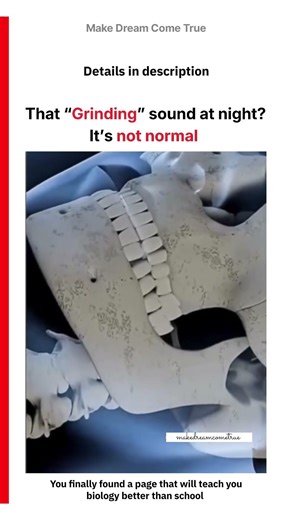 😬 That Grinding sound 💤 at night? It’s not normal 🦷| MDCT