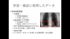 ヘルスケア業界での利用事例から読み解くAIへのニーズ