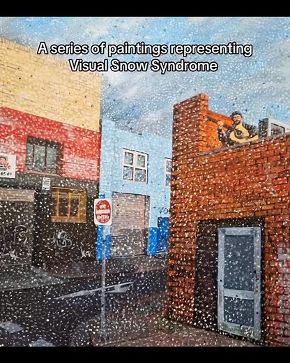 139 reactions · 26 shares | These artworks were created by talented members of our Visual Snow Syndrome community. Each art piece is a reflection of their unique way of seeing the world.  To share your own art, visit our website at https://www.visualsnowinitiative.org/wow-submit/ | Visual Snow Initiative | Facebook