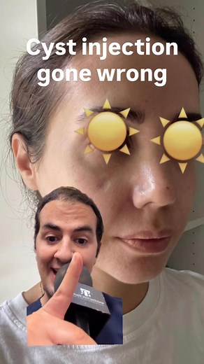 Washington Square Dermatology on Instagram: "✨ Quick relief for painful cysts — steroid injections are a game changer! 💉 They shrink cysts fast and prevent scarring. But remember: technique and skill matter. Always trust a Dermatology provider to avoid unwanted indentations. Healthy skin starts with smart choices 💪 #DermTips #CystRelief #SkinCareMatters"
