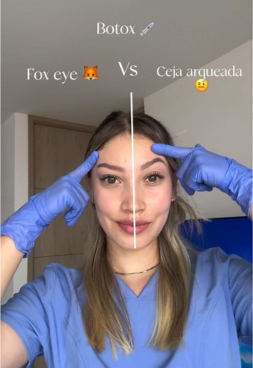 Tutorial de Foxy Eyes con Botox