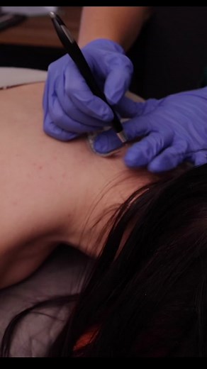 Tingly ASMR spine tracing #asmrvideo #chilibasmr #fyp #relax #asmrroleplay #asmrforsleep #asmrdoctor #asmrchiropractic #asmreyeexam