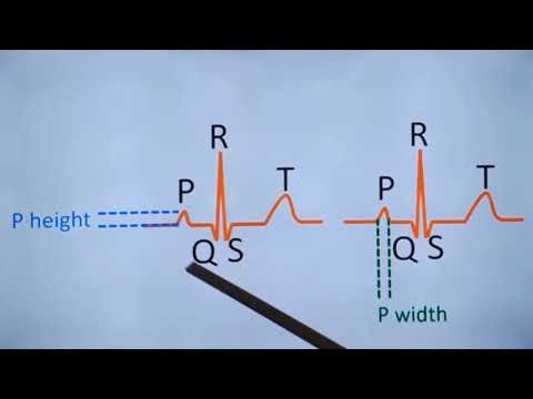 Important Normal Values for ECG