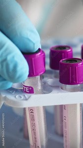 Process of coronavirus PCR antigen testing examination by nurse medic in laboratory lab, COVID-19 swab collection kit, test tube for taking OP NP patient specimen sample, patient receiving test