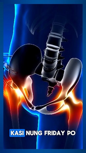 𝑻𝑰𝑻 𝑻𝑨𝑹 𝑻𝑰𝑷𝑺 𝑩𝒀 𝑴𝑨𝑺𝑻𝑬𝑹 𝑲𝑨𝑹𝑳 𝑯𝑶𝑴𝑬 𝑹𝑬𝑴𝑬𝑫𝒀 . . . #wellnessjourney #healthandwellness #tittar #fypシviralシ2024 #homeremedy #sciaticnervepain #SciaticaRelief #Sciatica #sciaticatreatment | Tit Tar Clinic by Master Karl - Oriental Bone Setting