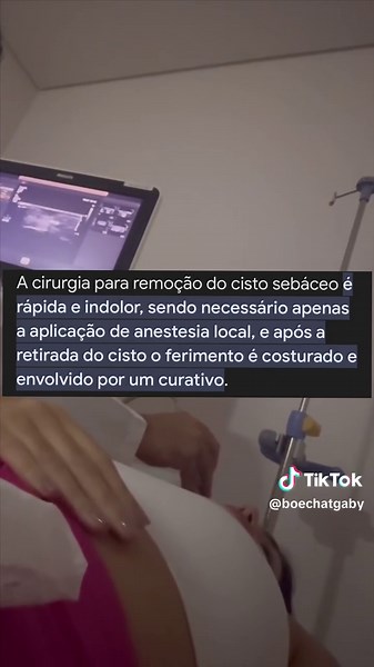Cisto Sebáceo: Cirurgia, Tratamento e Cicatrização - Relato de Caso