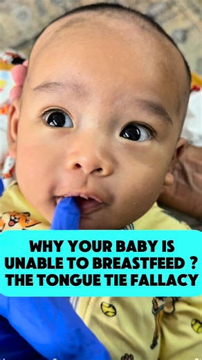 Nicolas Grimaldi | Tongue and lip ties have become a trend in recent years, first identified as the cause for latching disorders and now for many more unclear... | Instagram