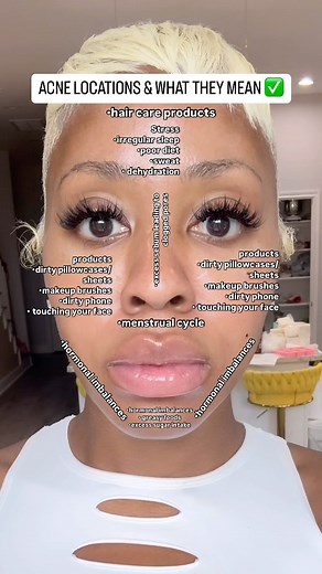 NEATFREAKK on Instagram: "FACE MAPPING CAN …ask questions ⬇️ help you avoid acne triggers and allow you treat o it properly with the right products. ✅• Clear skin bar ~cleanse your skin of all impurities & black heads antibacterial antifungal made with carrots, zinc, lemon peels orange peels licorice wrote and goat milk ✅• Glo mask brightening bar ~ Remove dark marks, hyperpigmentation, uneven skin tone, Brighten, and lighten imperfect areas made with turmeric, ginger, licorice root, alpha Artbu