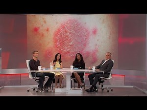 Could This Happen to Me?: Nummular Dermatitis