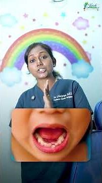 🦷 Lost a Baby Tooth Too Early? This Can Affect Permanent Teeth! | Pediatric Dentist Explains !