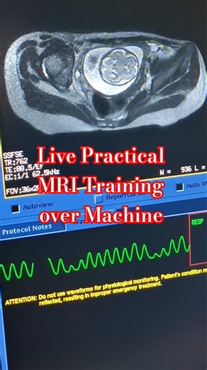 MRI of Pregnant women | pediatric fetus brain #shortsfeed #viral #shorts #shortvideo