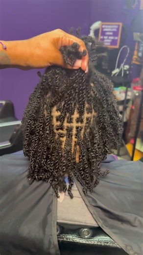 Understanding Alopecia Types in African Hair
