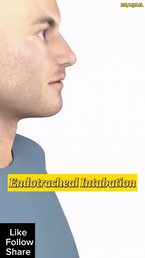 Medical Taqat Serup and Endoscopy Procedure Tips and Tricks