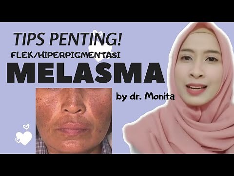 How to Remove Melasma Spots on Your Face Safely and Quickly | by Dr. Monita