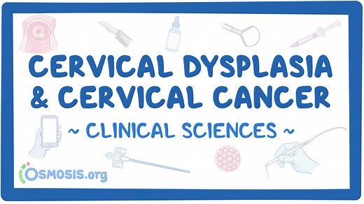 Cervical dysplasia and cervical cancer: Video & Meaning | Osmosis