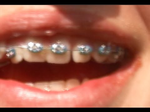 Merryn Jeann - ME B4 U (Official Video)