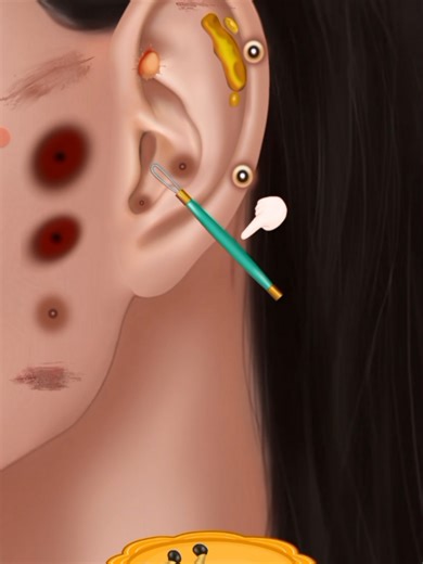 Ear Treatment ASMR: Satisfying Relaxation Techniques