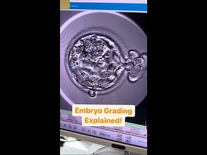 Embryo Grading Explained!