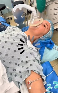 Anesthesia Challenge #anesthesia #challenge #doctor #hospital #dentist | hat.gau5