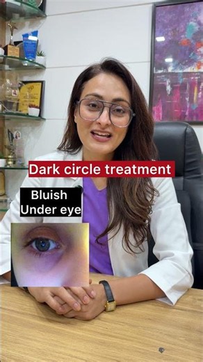 Dark circle treatment