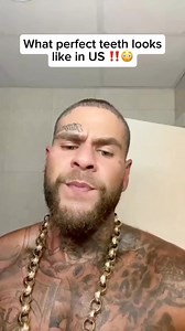 Miswak is a natural teeth-cleaning stick made from the Salvadora persica tree, used for centuries across Africa. Many Africans still use miswak daily without toothpaste, and studies show it helps prevent cavities, whiten teeth, and support gum health often outperforming modern toothbrushes. #cavities #toothbrush #teethwhitening | Healthy living