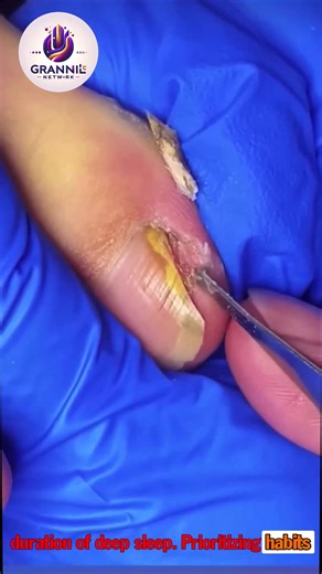 9.7K views · 63 reactions | 171 Preventive home-based foot support for older adults #FootCareTips #DiabeticFootCare #SafeSteps | Grand15 | Facebook