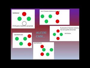 Tutorial luci di Worth