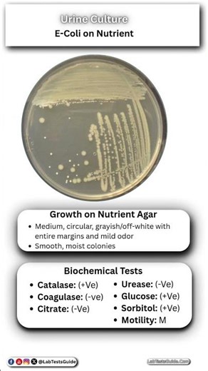 E Coli Growth on Nutrient Agar in Urine
