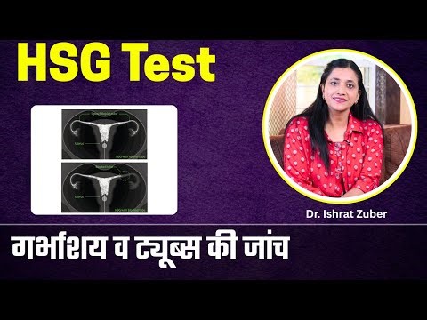 HSG Test क्या होता है ? | गर्भाशय और Fallopian Tubes की जांच Hysterosalpingography