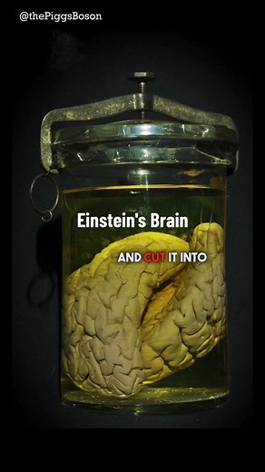 The Strange Story of Einstein's Brain