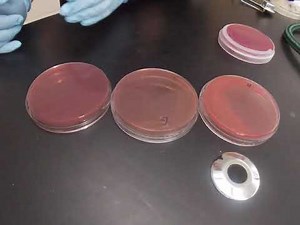 Macconkey Agar