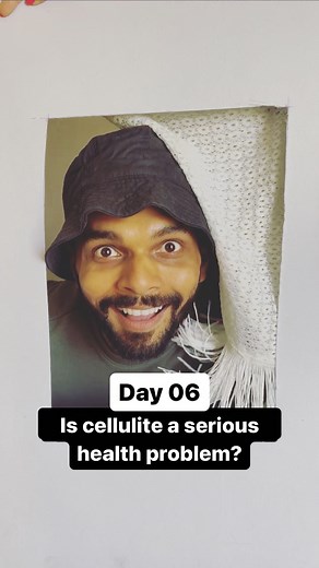 15K views · 17 reactions | Day 06: Is cellulite dangerous? Cellulite...