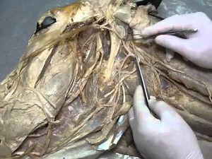 Arteries of the deep dissection of the head by dr khaled shoghy