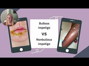 NP Learning: Pediatric Dermatologic Conditions